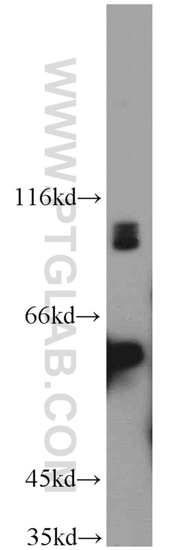 MAP4K2 Antibody in Western Blot (WB)