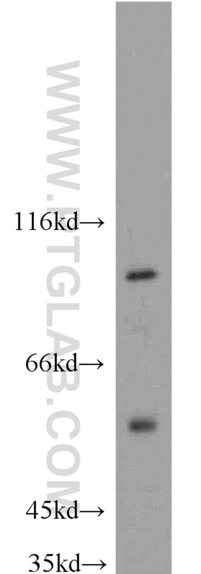 MAP4K2 Antibody in Western Blot (WB)