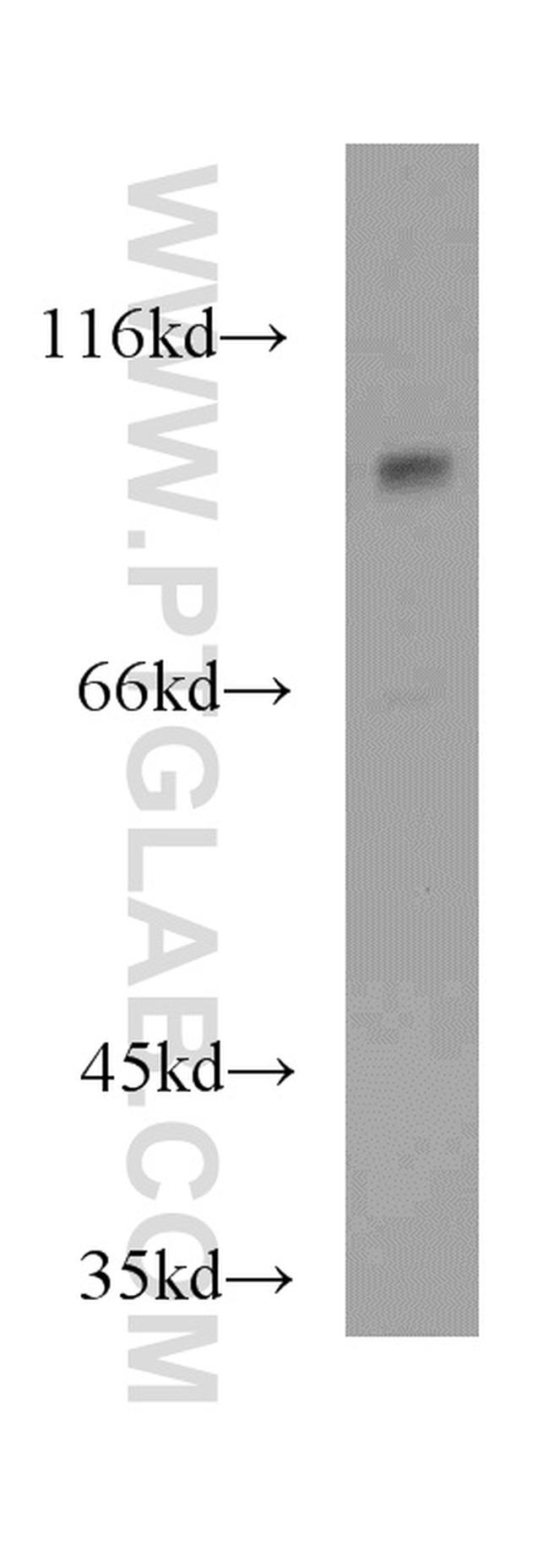 MAP4K2 Antibody in Western Blot (WB)