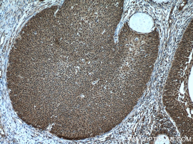 CARM1 Antibody in Immunohistochemistry (Paraffin) (IHC (P))