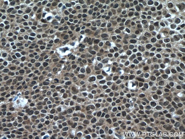 CARM1 Antibody in Immunohistochemistry (Paraffin) (IHC (P))