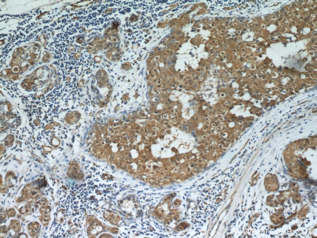 CARM1 Antibody in Immunohistochemistry (Paraffin) (IHC (P))