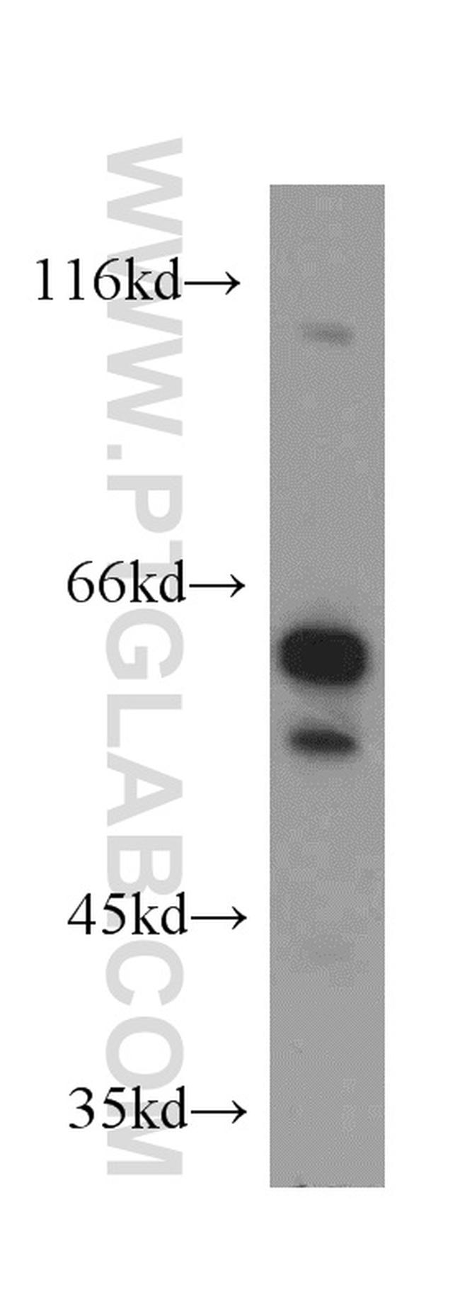 CARM1 Antibody in Western Blot (WB)