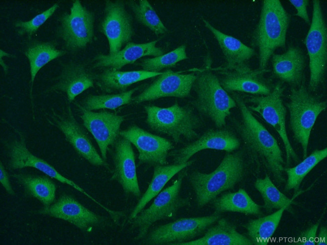 CARM1 Antibody in Immunocytochemistry (ICC/IF)