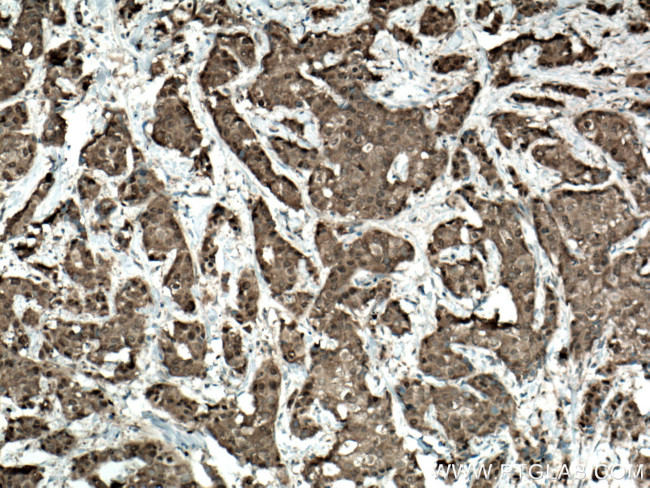 CARM1 Antibody in Immunohistochemistry (Paraffin) (IHC (P))