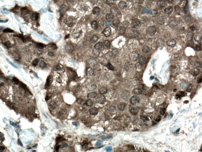 CARM1 Antibody in Immunohistochemistry (Paraffin) (IHC (P))