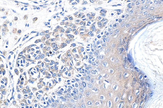 CARM1 Antibody in Immunohistochemistry (Paraffin) (IHC (P))