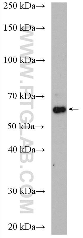 CARM1 Antibody in Western Blot (WB)