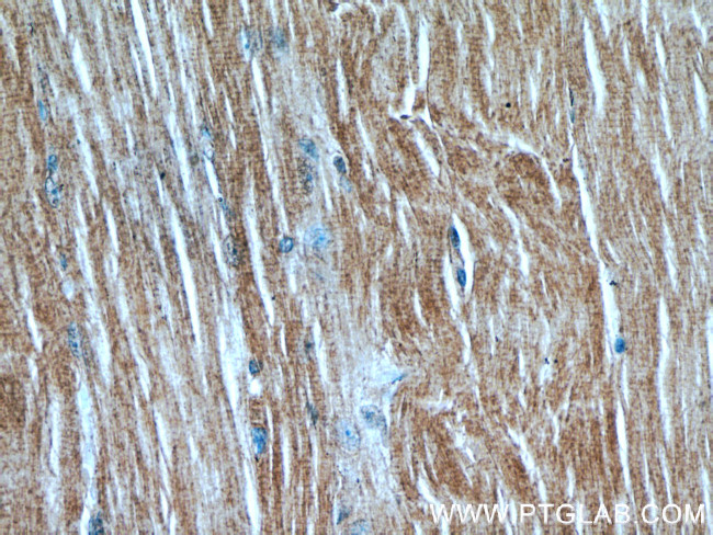 MAP4K4 Antibody in Immunohistochemistry (Paraffin) (IHC (P))