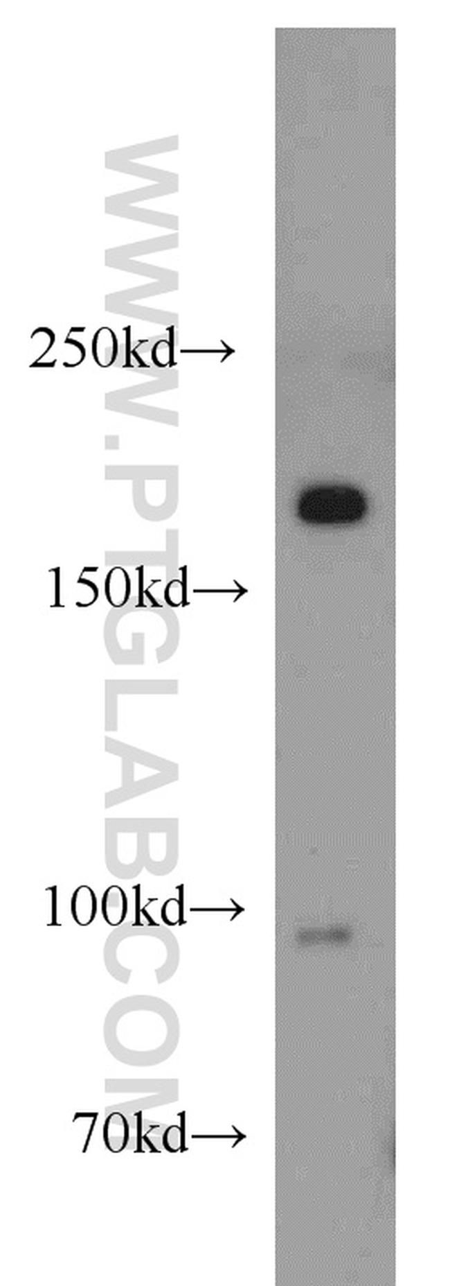 MAP4K4 Antibody in Western Blot (WB)