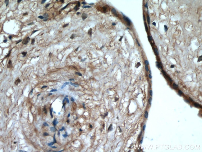 MAP4K4 Antibody in Immunohistochemistry (Paraffin) (IHC (P))