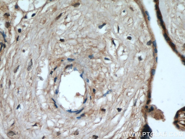 MAP4K4 Antibody in Immunohistochemistry (Paraffin) (IHC (P))