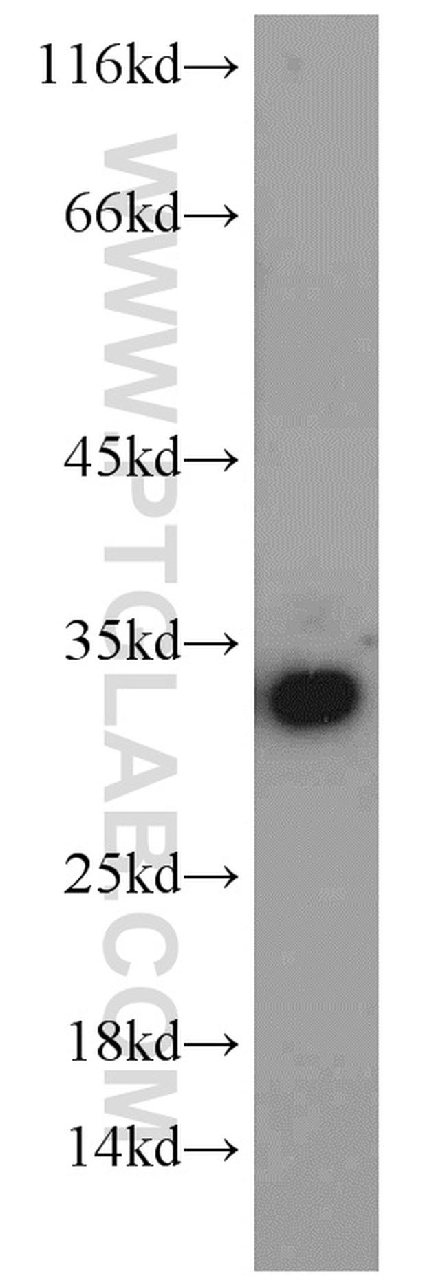 GPR35 Antibody in Western Blot (WB)