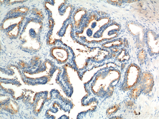 GPR55 Antibody in Immunohistochemistry (Paraffin) (IHC (P))