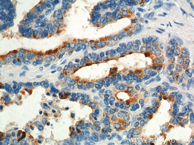 GPR55 Antibody in Immunohistochemistry (Paraffin) (IHC (P))