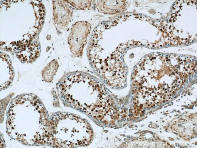 MORF4L1 Antibody in Immunohistochemistry (Paraffin) (IHC (P))