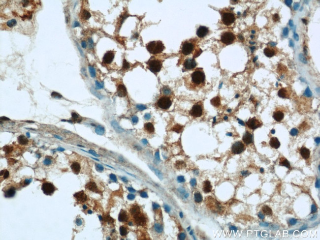 MORF4L1 Antibody in Immunohistochemistry (Paraffin) (IHC (P))