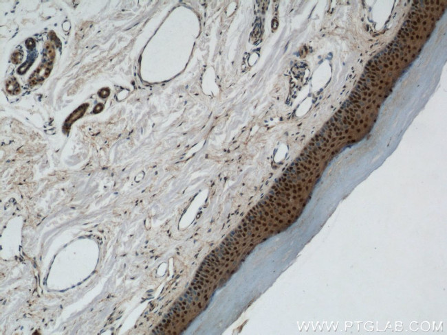 MORF4L1 Antibody in Immunohistochemistry (Paraffin) (IHC (P))