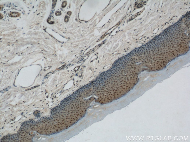 MORF4L1 Antibody in Immunohistochemistry (Paraffin) (IHC (P))