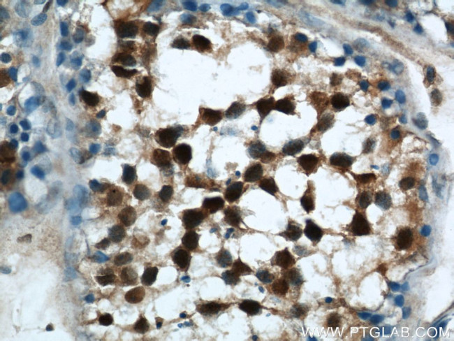 MORF4L1 Antibody in Immunohistochemistry (Paraffin) (IHC (P))