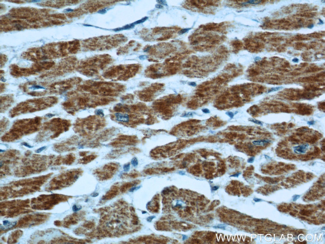 VDAC1/Porin Antibody in Immunohistochemistry (Paraffin) (IHC (P))