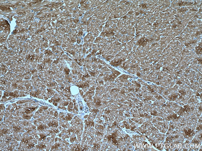 VDAC1/Porin Antibody in Immunohistochemistry (Paraffin) (IHC (P))