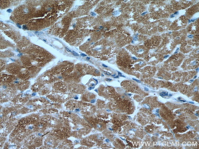 VDAC1/Porin Antibody in Immunohistochemistry (Paraffin) (IHC (P))