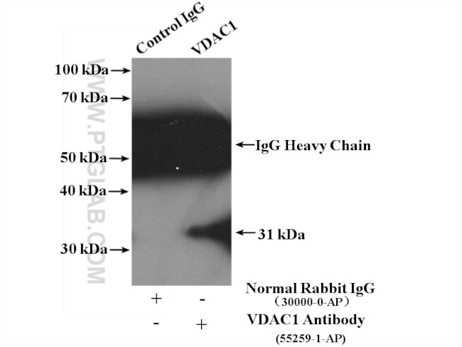 VDAC1/Porin Antibody in Immunoprecipitation (IP)