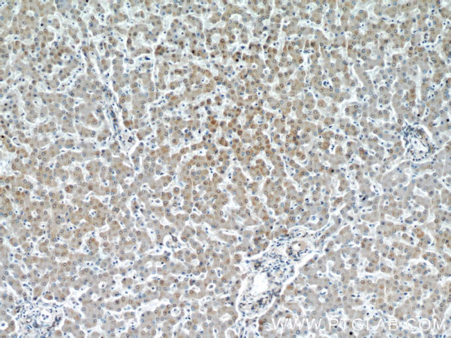 VDAC1/Porin Antibody in Immunohistochemistry (Paraffin) (IHC (P))