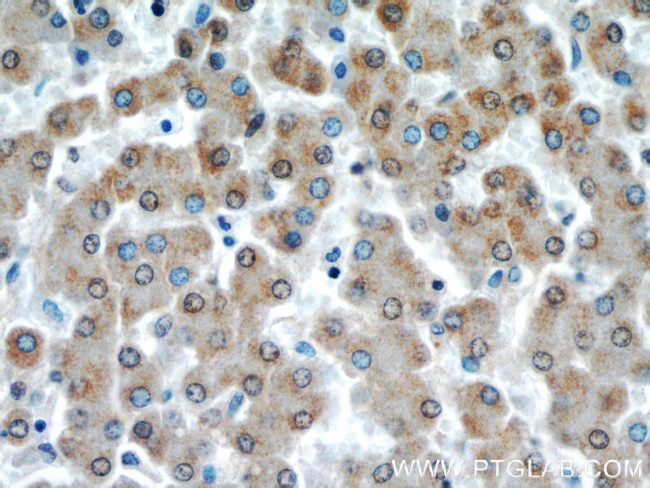 VDAC1/Porin Antibody in Immunohistochemistry (Paraffin) (IHC (P))