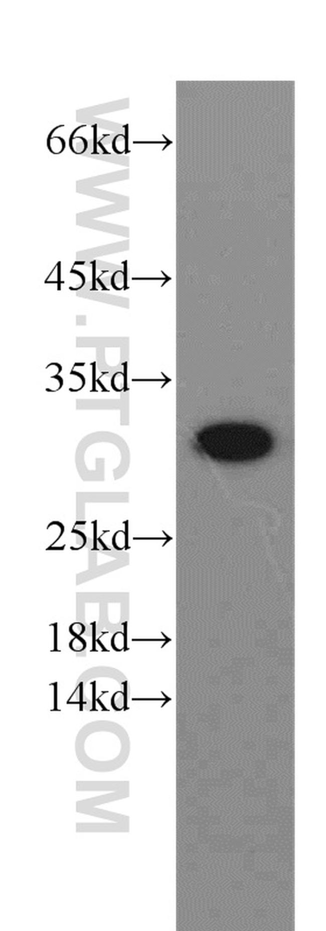 VDAC1/Porin Antibody in Western Blot (WB)