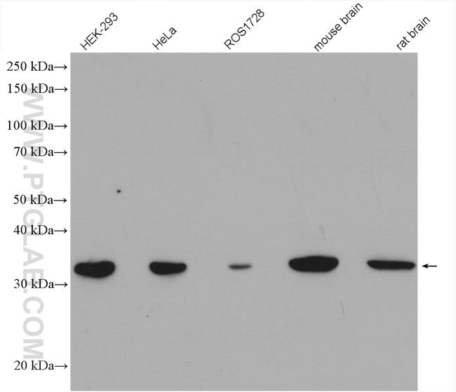 VDAC1/Porin Antibody in Western Blot (WB)