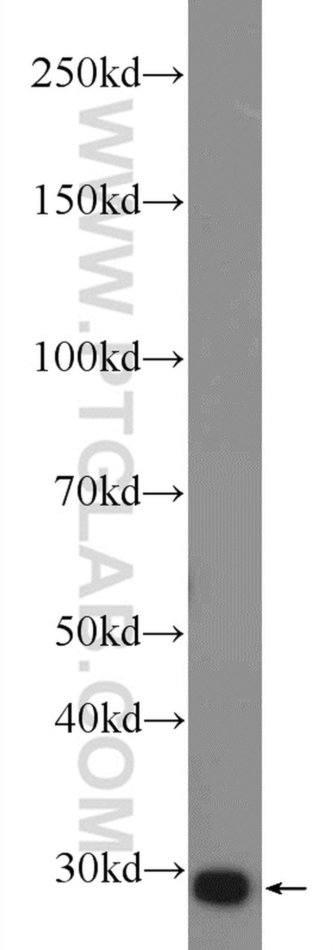 VDAC1/Porin Antibody in Western Blot (WB)