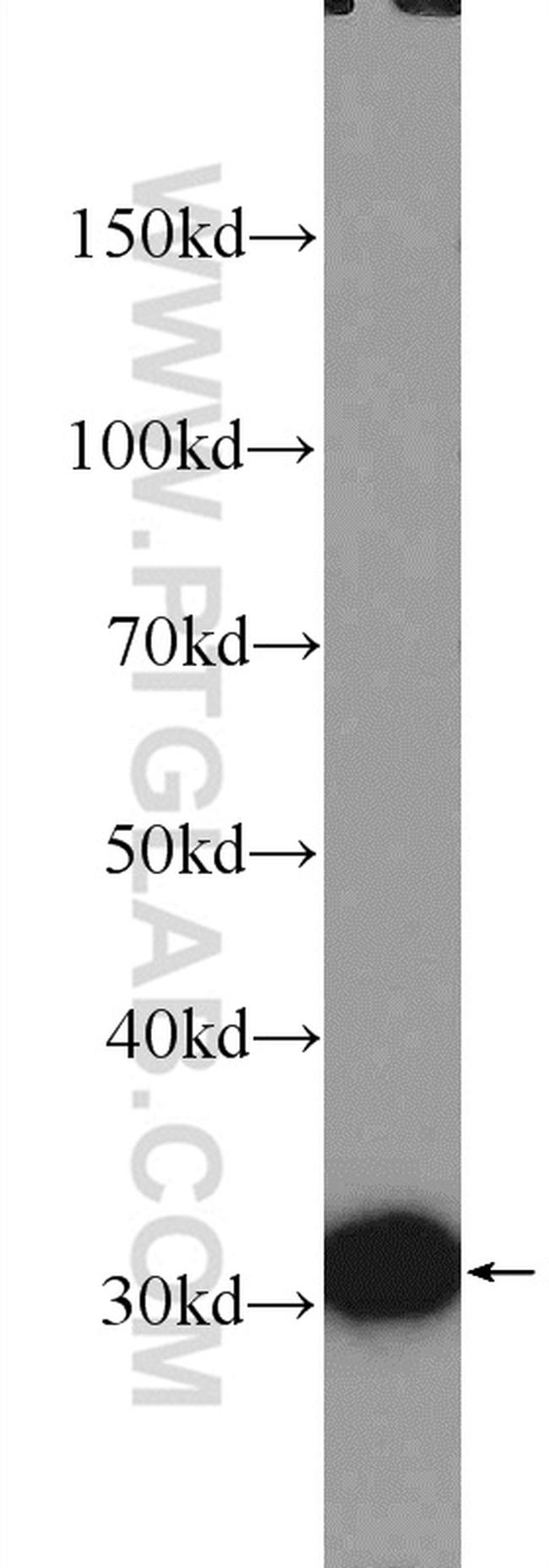 VDAC1/Porin Antibody in Western Blot (WB)