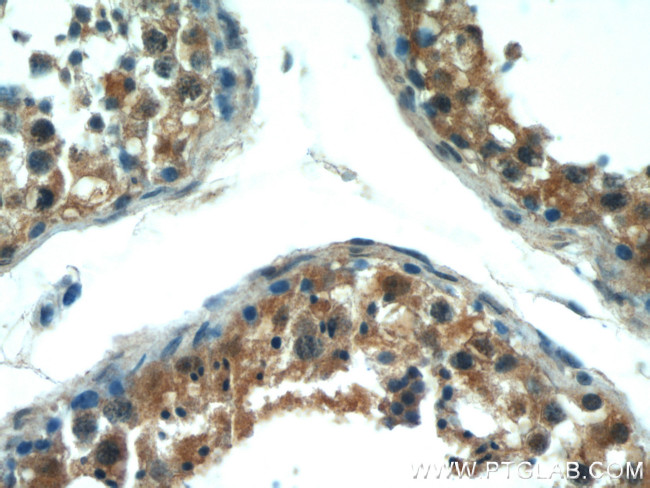 VDAC3 Antibody in Immunohistochemistry (Paraffin) (IHC (P))