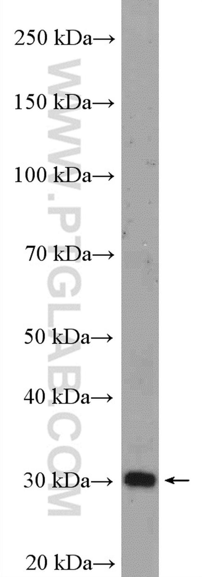 VDAC3 Antibody in Western Blot (WB)