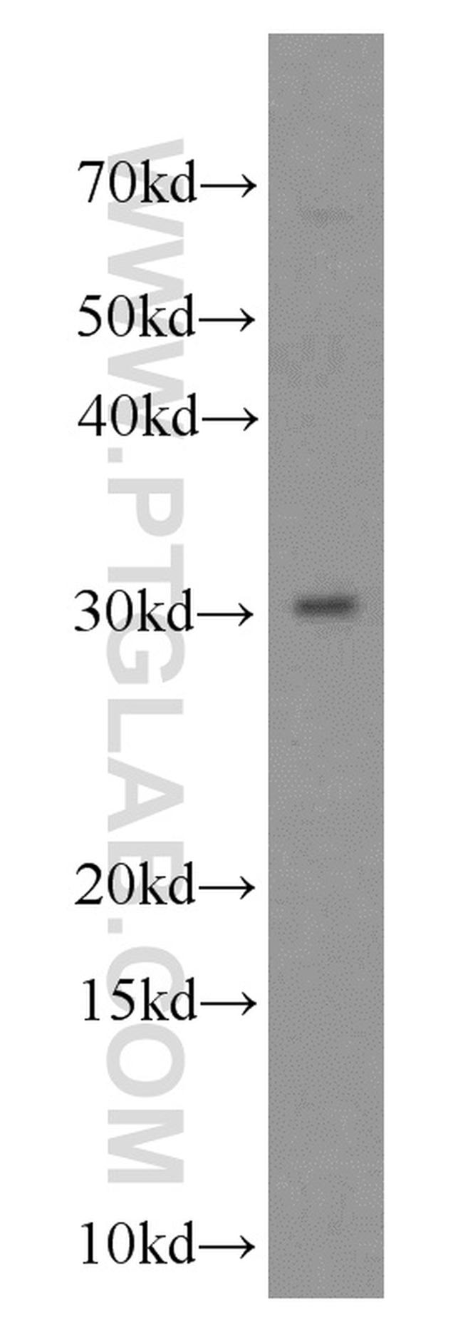 VDAC3 Antibody in Western Blot (WB)