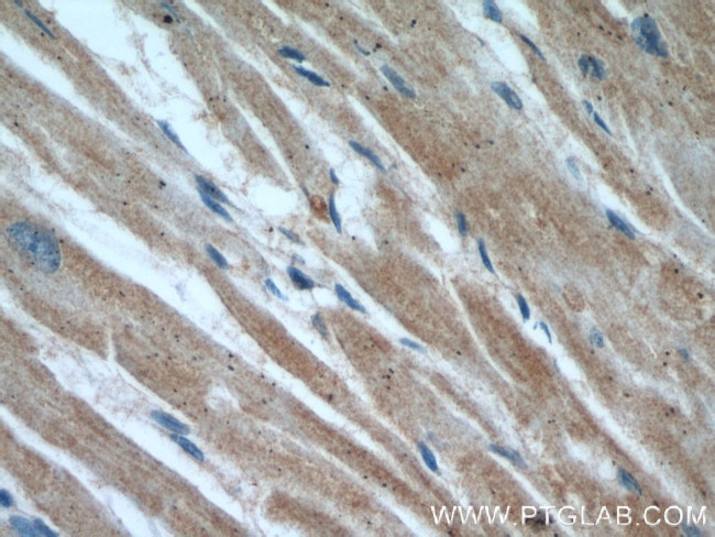 VDAC2 Antibody in Immunohistochemistry (Paraffin) (IHC (P))