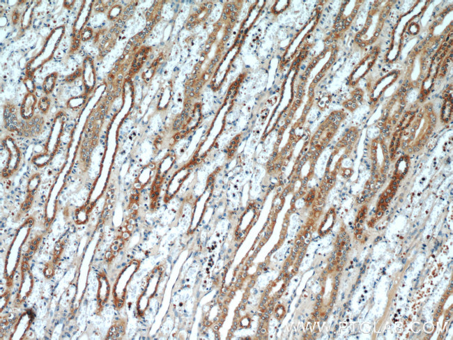 VDAC2 Antibody in Immunohistochemistry (Paraffin) (IHC (P))