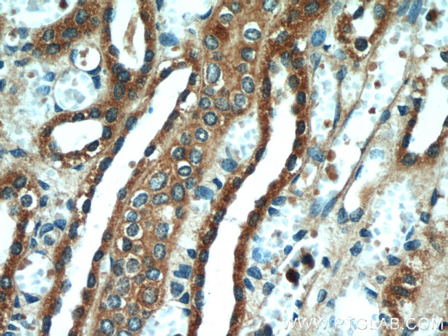 VDAC2 Antibody in Immunohistochemistry (Paraffin) (IHC (P))