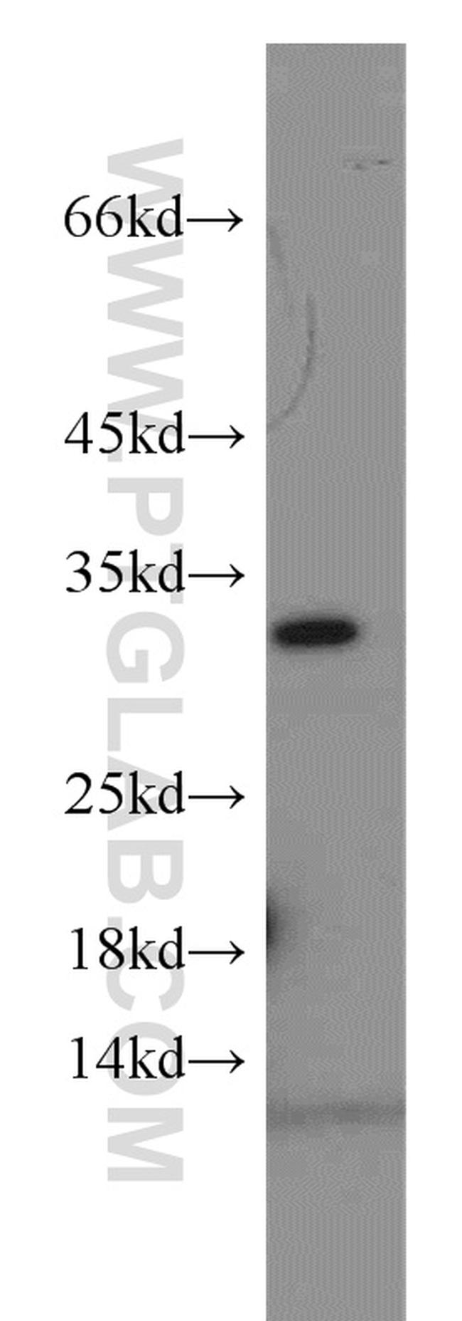 VDAC2 Antibody in Western Blot (WB)