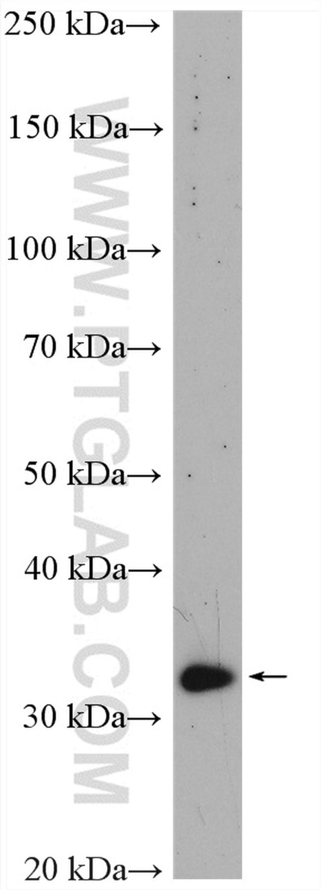 VDAC2 Antibody in Western Blot (WB)