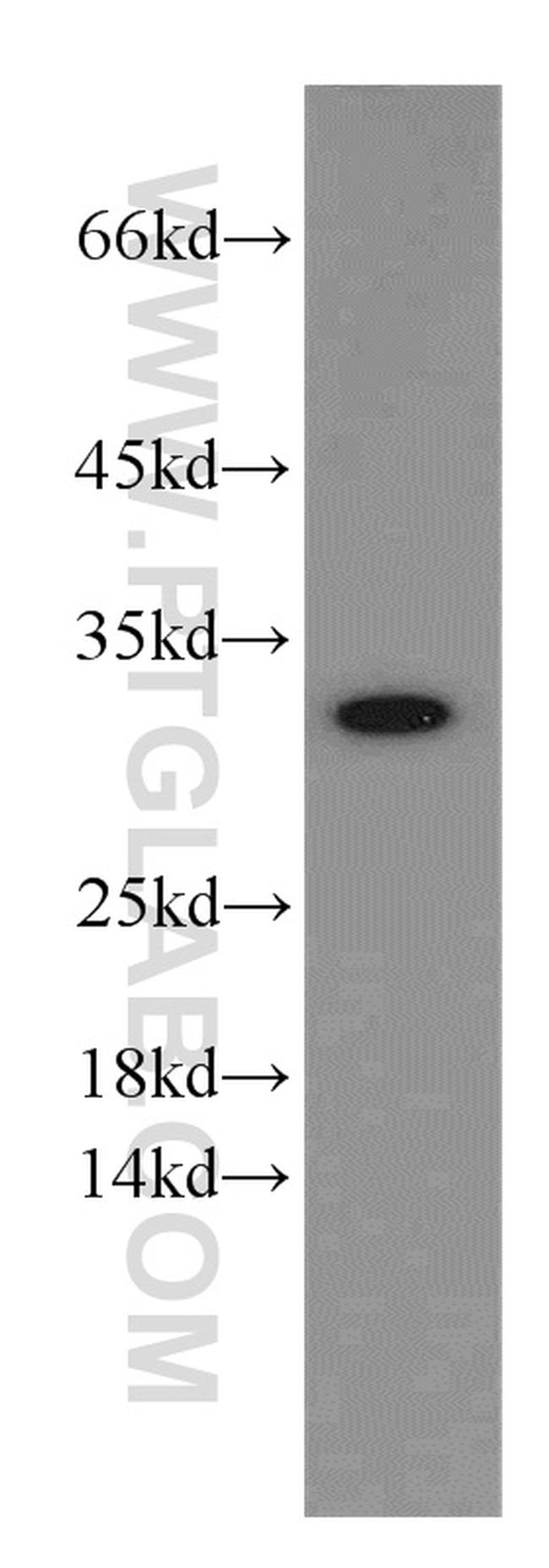 VDAC2 Antibody in Western Blot (WB)