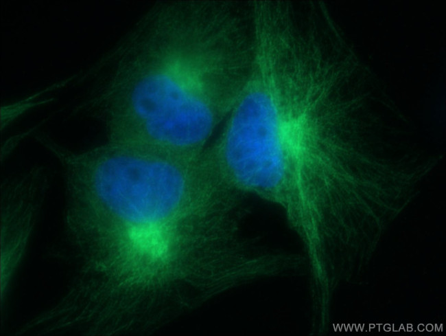 PARVA Antibody in Immunocytochemistry (ICC/IF)