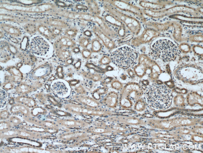 PARVA Antibody in Immunohistochemistry (Paraffin) (IHC (P))