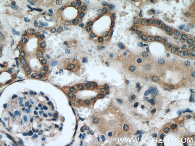 PARVA Antibody in Immunohistochemistry (Paraffin) (IHC (P))