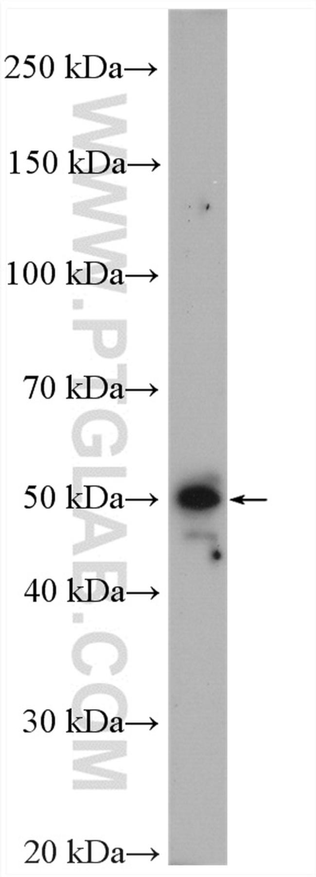 PARVA Antibody in Western Blot (WB)