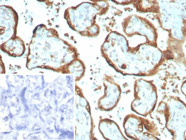 IMP-3 Antibody in Immunohistochemistry (Paraffin) (IHC (P))