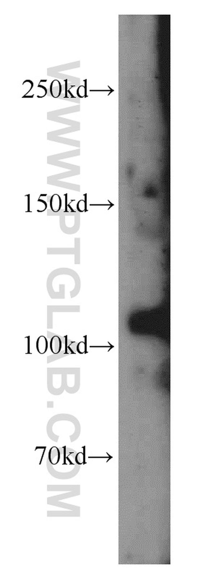 CASK Antibody in Western Blot (WB)