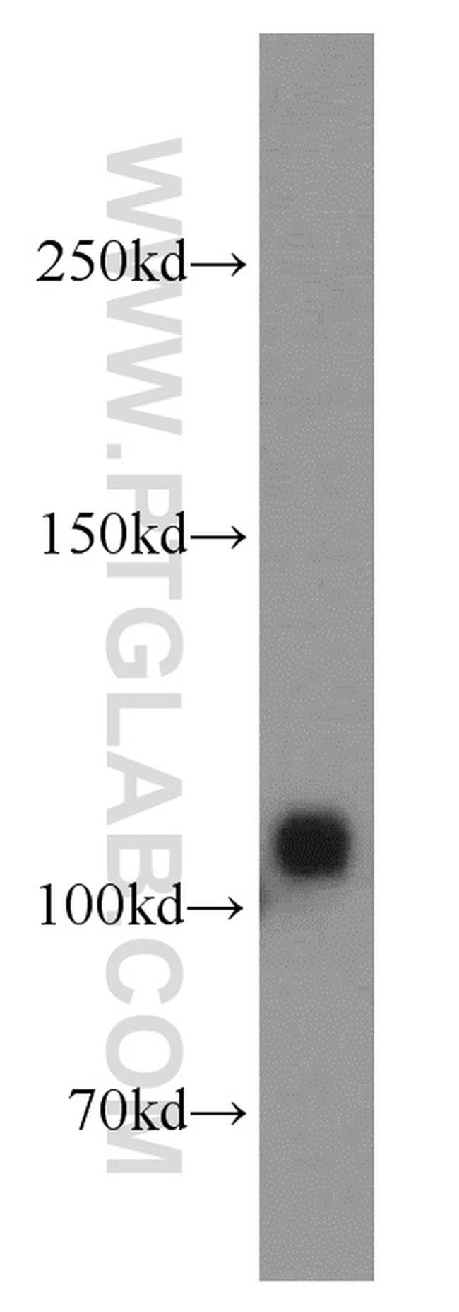 CASK Antibody in Western Blot (WB)